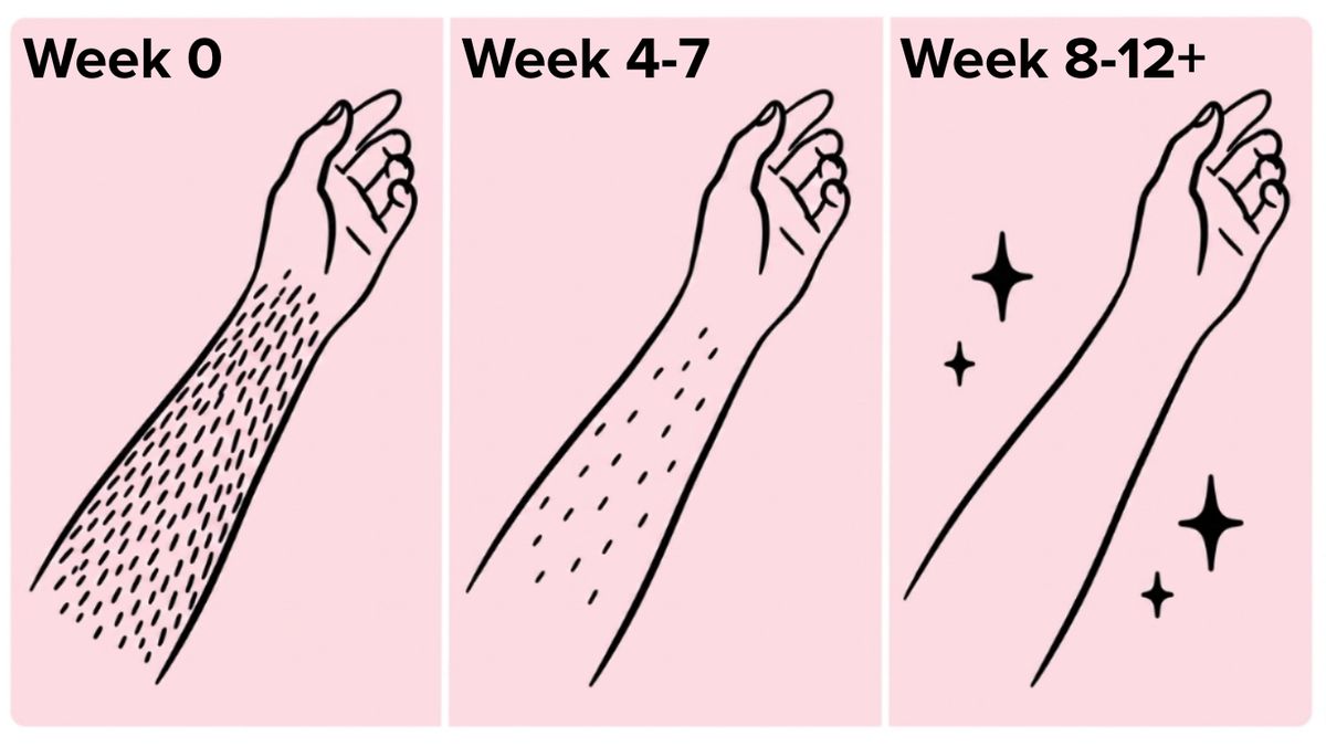 Three stages: slower growth, noticeably less, virtually hair-free